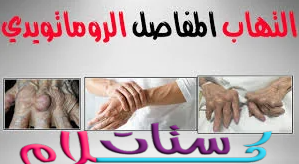 اسباب التهاب المفاصل الروماتويدي